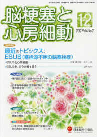 脳梗塞と心房細動 〈Ｖｏｌ．４　Ｎｏ．２（２０１７〉 最近のトピックス：ＥＳＵＳ（塞栓源不明の脳塞栓症）