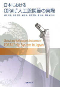 日本におけるＣＯＲＡＩＬ（Ｒ）人工股関節の実際