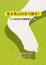 巻き爪は自分で治せ！ - ＳＨ式自己治療装具の紹介