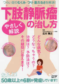やさしく解説下肢静脈溜の治し方 - つらい足のむくみ・つり・重だるさを解消！ ＧＥＩＢＵＮ　ＭＯＯＫＳ　はつらつ元氣特選ムック