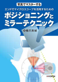 写真でマスターする<br> エンドでマイクロスコープを活用するためのポジショニングとミラーテクニック