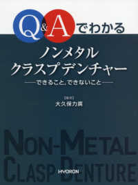 Ｑ＆Ａでわかるノンメタルクラスプデンチャー - できること、できないこと