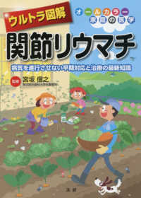 オールカラー家庭の医学<br> ウルトラ図解　関節リウマチ―病気を進行させない早期対応と治療の最新知識