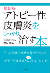 最新版　アトピー性皮膚炎をしっかり治す本