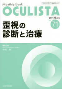 歪視の診断と治療 ＭＢ　ＯＣＵＬＩＳＴＡ
