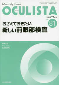 おさえておきたい新しい前眼部検査 ＭＢ　ＯＣＵＬＩＳＴＡ