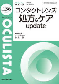 コンタクトレンズ処方＆ケア　ｕｐｄａｔｅ ＭＢ　ＯＣＵＬＩＳＴＡ