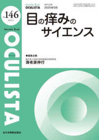 目の痒みのサイエンス ＭＢ　ＯＣＵＬＩＳＴＡ