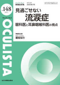 見過ごせない流涙症　眼科医と耳鼻咽喉科医の視点 ＭＢ　ＯＣＵＬＩＳＴＡ