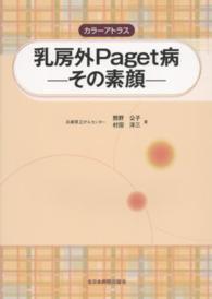 カラーアトラス乳房外Ｐａｇｅｔ病－その素顔－