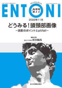どうみる！頭頚部画像－読影のポイントとｐｉｔｆａｌｌ－ ＭＢ　ＥＮＴＯＮＩ