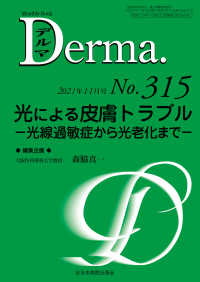 Ｄｅｒｍａ． 〈Ｎｏ．３１５（２０２１年１１月〉 - Ｍｏｎｔｈｌｙ　Ｂｏｏｋ 光による皮膚トラブル　光線過敏症から光老化まで