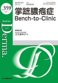 掌蹠膿疱症Ｂｅｎｃｈ－ｔｏ－Ｃｌｉｎｉｃ - 困ったときの次の一手 ＭＢ　Ｄｅｒｍａ．