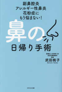 鼻の日帰り手術―副鼻腔炎　アレルギー性鼻炎　花粉症にもう悩まない！