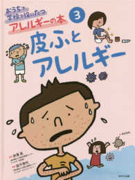 おうちで学校で役にたつアレルギーの本〈３〉皮ふとアレルギー