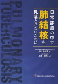 日常診療の中で肺結核を見落とさないために