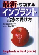 最新・成功するインプラント治療の受け方