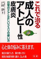 これで治る成人のアトピー性皮膚炎 - 日常のケアと正しいクスリの使い方