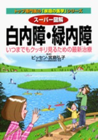 スーパー図解白内障・緑内障 - いつまでもクッキリ見るための最新治療 トップ専門医の「家庭の医学」シリーズ