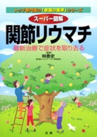 トップ専門医の「家庭の医学」シリーズ<br> スーパー図解　関節リウマチ―最新治療で症状を取り去る