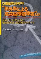 交通事故で多発する“脳外傷による高次脳機能障害”とは―見過ごしてはならない脳画像所見と臨床症状のすべて