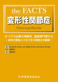 ｔｈｅ　ＦＡＣＴＳ変形性関節症 - すべての必要な情報を，直接専門家から