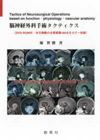 脳神経外科手術タクティクス - ＤＶＤ－ＲＯＭ付：本文掲載の主要画像１８５点をカラ