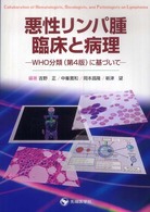 悪性リンパ腫・臨床と病理 - ＷＨＯ分類（第４版）に基づいて