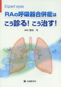 ＲＡの呼吸器合併症はこう診る！こう治す！ Ｅｘｐｅｒｔ　ｅｙｅｓ