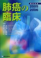 Ｍｏｏｋ肺癌の臨床 〈２００５－２００６〉 - 疫学・病理・発見・診断・治療