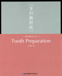 Ｔｏｏｔｈ　Ｐｒｅｐａｒａｔｉｏｎ［支台歯形成］ ＤＤ　Ｂａｓｉｃｓ