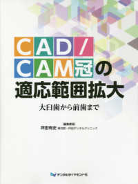 ＣＡＤ／ＣＡＭ冠の適応範囲拡大 - 大臼歯から前歯まで