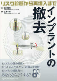 インプラントの撤去～リスク診断から再埋入まで～ - リスク診断から再埋入まで