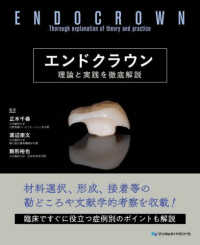 エンドクラウン - 理論と実践を徹底解説