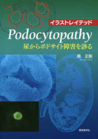 イラストレイテッドＰｏｄｏｃｙｔｏｐａｔｈｙ - 尿からポドサイト障害を診る