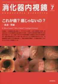 消化器内視鏡　１４年７月号 〈２６－７〉 これが癌？癌じゃないの？ 食道・胃編