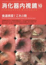 消化器内視鏡　１４年１０月号 〈２６－１０〉 食道病変！これ１冊