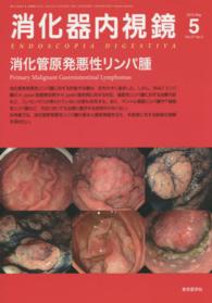 消化器内視鏡　１５年５月号 〈２７－５〉 消化管原発悪性リンパ腫