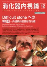 消化器内視鏡　１５年１２月号 〈２７－１２〉 Ｄｉｆｆｉｃｕｌｔ　ｓｔｏｎｅへの挑戦