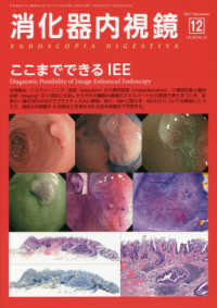 消化器内視鏡 〈Ｖｏｌ．２９　Ｎｏ．１２（２０〉 ここまでできるＩＥＥ