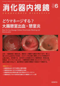 消化器内視鏡 〈Ｖｏｌ．３０　Ｎｏ．６（２０１〉 どうマネージする？大腸憩室出血・憩室炎