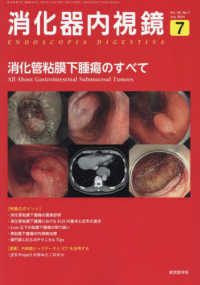 消化器内視鏡 〈Ｖｏｌ．３６　Ｎｏ．７（２０２〉 消化管粘膜下腫瘍のすべて