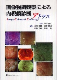 画像強調観察による内視鏡診断アトラス - ｉｍａｇｅ－ｅｎｈａｎｃｅｄ　ｅｎｄｏｓｃｏｐｙ