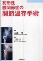 変形性股関節症の関節温存手術