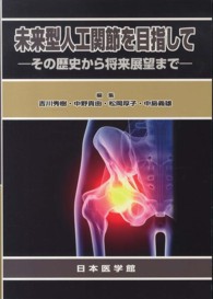 未来型人工関節を目指して―その歴史から将来展望まで