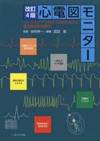 心電図モニター - ベッドサイドで役立つ波形の見方と緊急時対処の基本 （改訂４版）