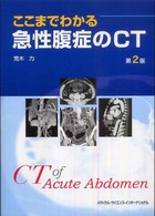 ここまでわかる急性腹症のＣＴ （第２版）