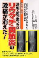 注射・薬が効かないリウマチ・関節炎の激痛が消えた！ - 臨床医の証言