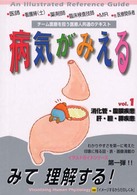 病気がみえる 〈ｖｏｌ．１〉 - 消化管・腹膜疾患／肝・胆・膵疾患