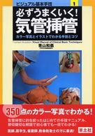 必ずうまくいく！気管挿管 - カラー写真とイラストでわかる手技とコツ ビジュアル基本手技